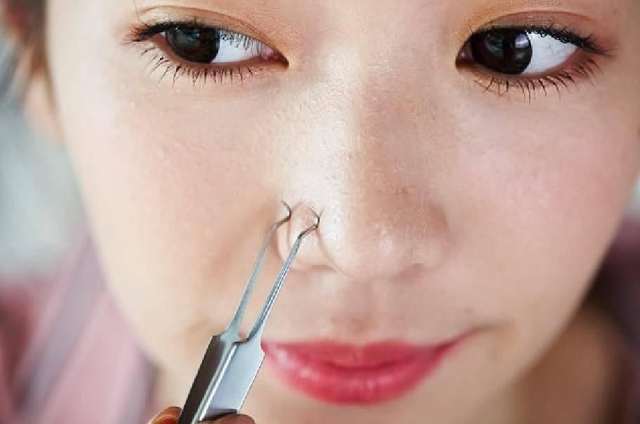 鼻子上挤出来的东西，分好几种，你知道几种呢?