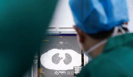  核酸|湖北不用等核酸检测就可确诊