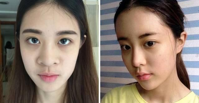  「看起来就」为什么做了整形也没有变好看
