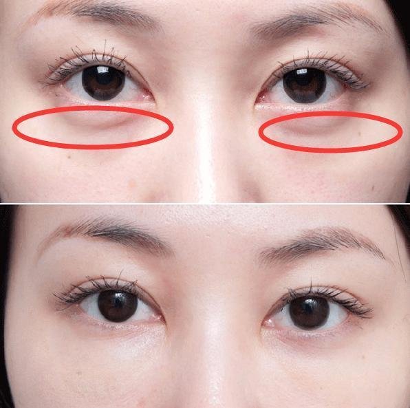 演员姥姥告诉我:药房一白菜价药粉，早晚各一次，眼纹全走开