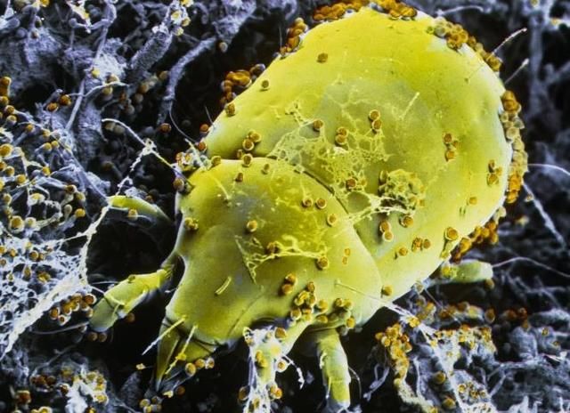 脸上螨虫成灾怎么办?用这一招，螨虫全都死光光