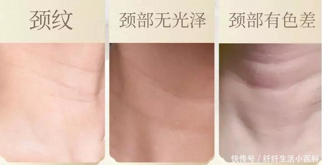  皮肤■18水龄：别让颈纹破坏了你的少女感！