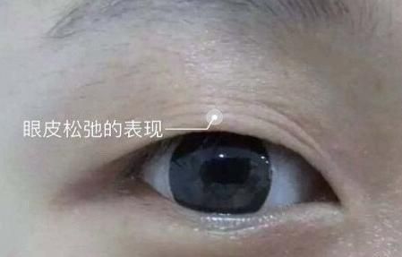  『好看』好看的单眼皮美到离谱！割双眼皮的意义在哪？