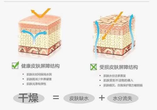  「款洗发」3款容易“踩雷”的洗发水，用后头痒又起头皮屑，没用过真的幸运