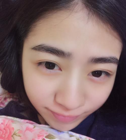 女生@被吓出一身冷汗,为何现在越来越少的女生割双眼皮?看到变化史后