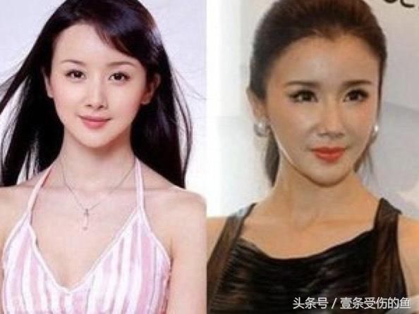 郭采洁公开回应整容，随后秒删，网友：看到的不一定是真实的