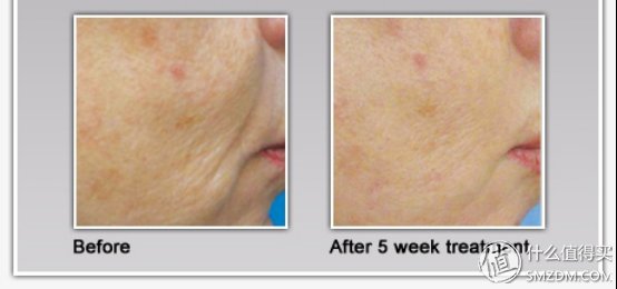 热门美容仪逐点评，真正值得投资的产品是哪个?