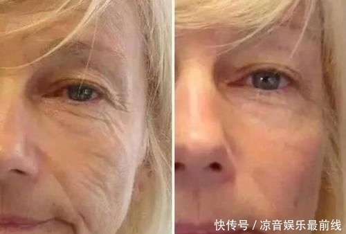 『皮肤』用了这么多护肤品之后,终于发现了抗衰老的秘诀,原来这么简单