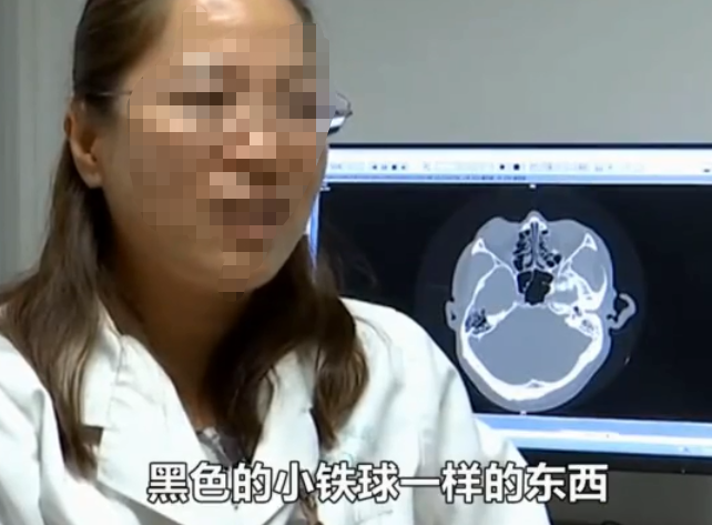 七旬老人耳朵流脓8年,打针吃药都没用,医生手