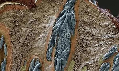 反复冒痘原来是螨虫作乱,家中寻常小物仅是一抹,痘痘螨虫不见