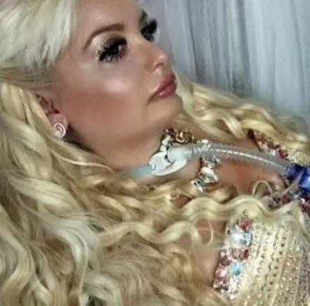 她四肢瘫痪仍坚持打扮成芭比娃娃的模样,如今成这样