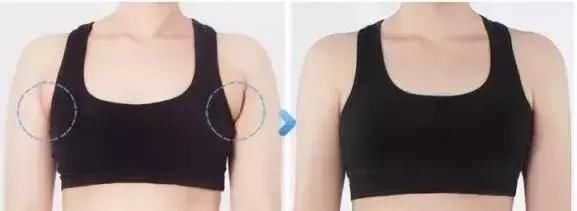 奚梦瑶 T 台走秀又崩了？这个部位不注意，夏天穿衣很尴尬