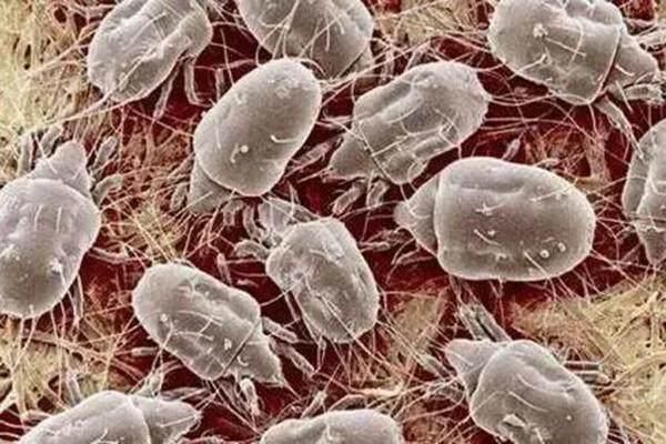 终算找到脸上螨虫的“死对头”了！学会3妙招，清空千万螨虫