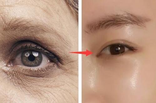 药店墙角一不起眼白色乳液，每晚涂一涂，满脸胶原蛋白