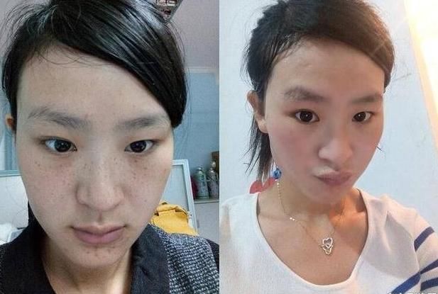 不管斑点皱纹？这样熬碗水，一夜祛斑！立马奏效，啥药不涂