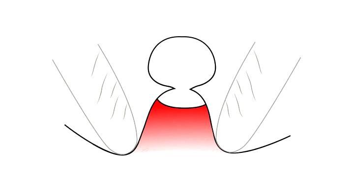  『脸上长』痘痘真不能“挤”？这误会大了，挤痘其实能让痘痘消得更快！