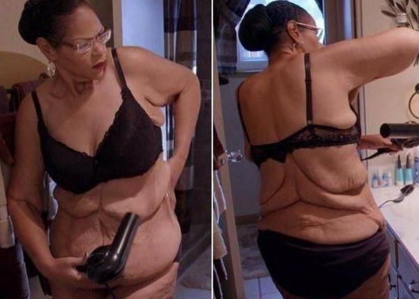 外国一女子2年减肥400斤，导致自身出现隐患，洗澡后要用吹风