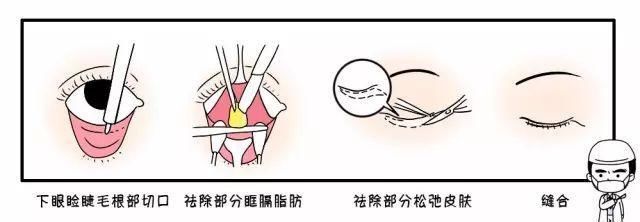  [熬夜]明明说好一起熬夜的，为什么就只有你熬出了眼袋+黑眼圈？