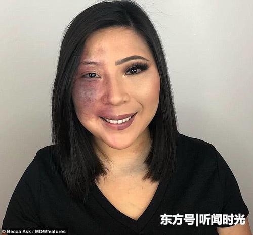 美国女子满脸胎记从小遭歧视,为改变多年苦练化妆术惊艳旁人
