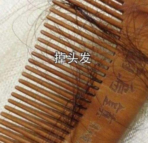  『拥有一头』16岁女孩长期“不剪头发”，身体出现这变化，女生请务必了解！