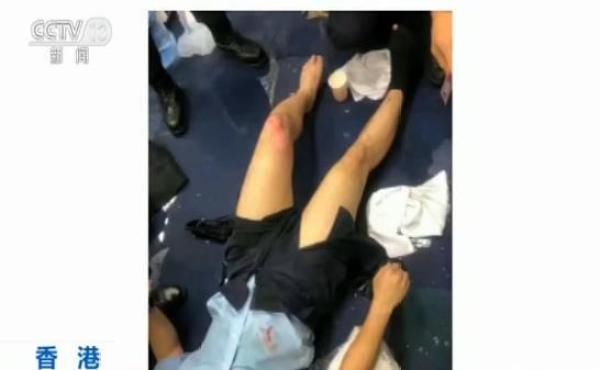 央视独家采访遭汽油弹袭击受伤香港警员 更多现场细节曝光