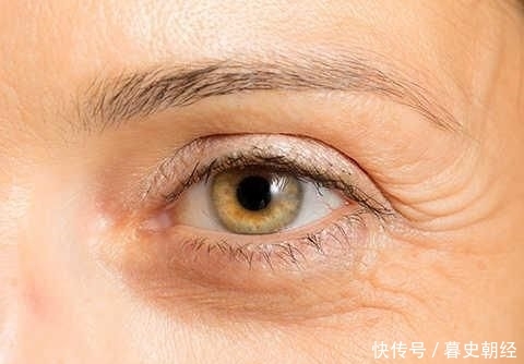 『皮肤』小细纹和表情纹有什么不同?皱纹的分类和形成原因