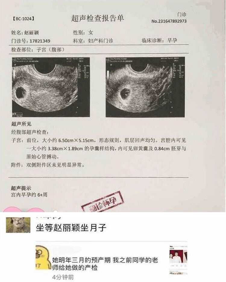 赵丽颖孕检B超单曝光，有人猜测男孩，预产期为明年