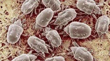 怎么杀死被子里的螨虫, 邻居阿姨教我三招, 杀菌