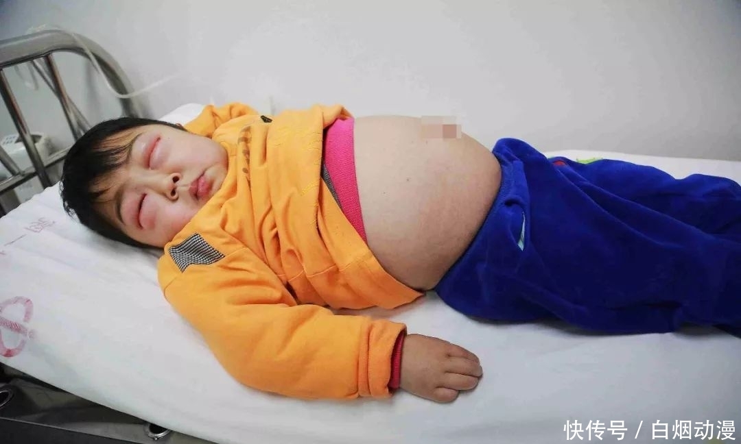  「发病」4岁男童患怪病病好时帅帅的，发病时肚大像怀孕双眼只剩一条线！