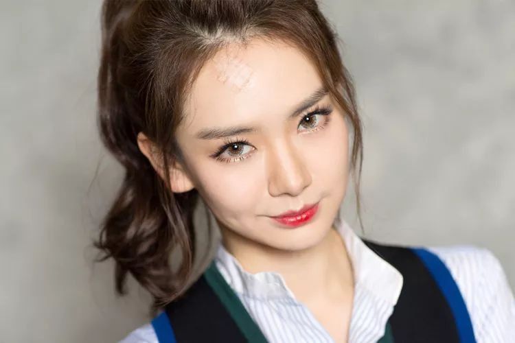 惊!戚薇开眼角了?还是无痛的