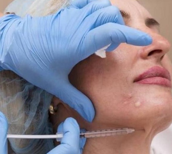 英国姥姥为美，花费11万去做整容，让男朋友有危机感