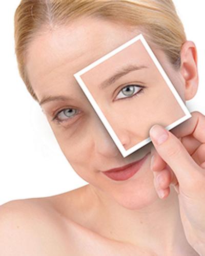 怎样能消除眼袋?平时要注意什么?