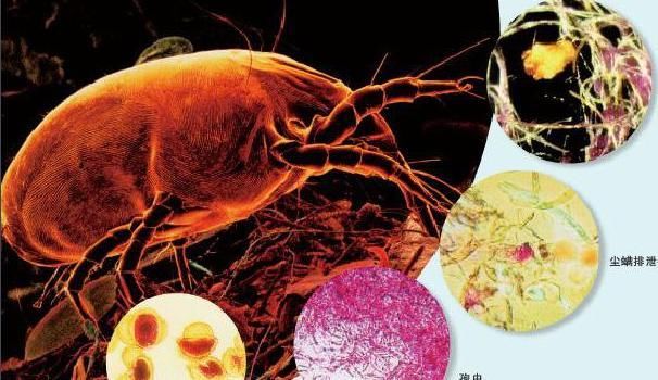 鼻子周围挤出的分泌物，原来是螨虫的分泌物，2招教你清除