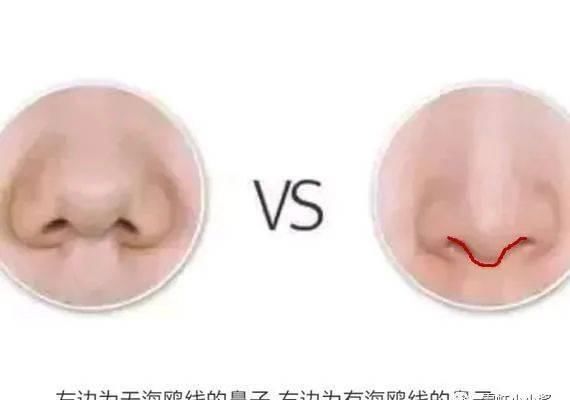  「好看」鼻子做成什么样才好看，一篇务实的鼻修复参考（三）|日本医美