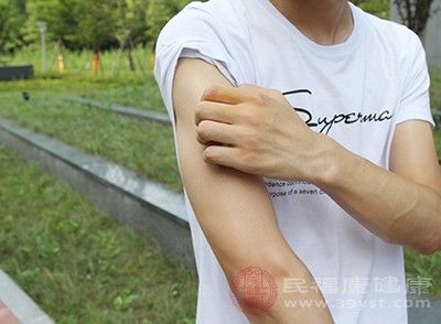  过敏症状：皮肤过敏的原因 换季竟会引起这个问题