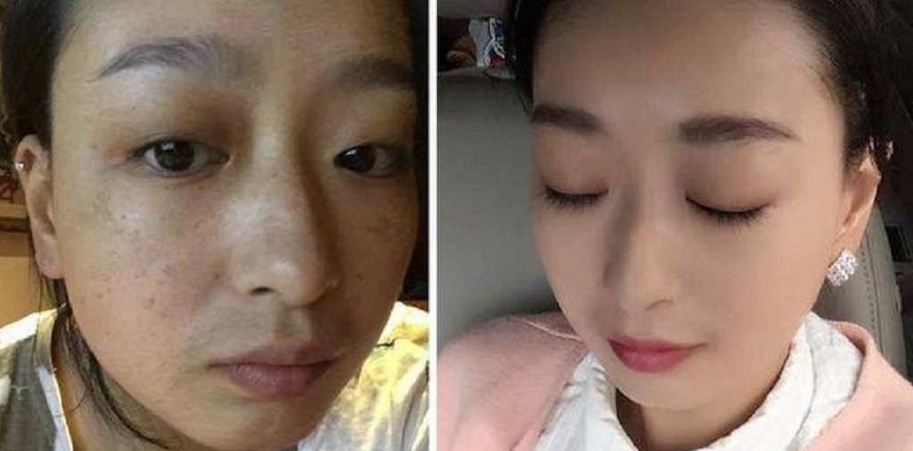  #皮肤问题#一碗淘米水加“它”敷脸，不出半个月赶走色斑暗沉，皮肤白嫩细腻