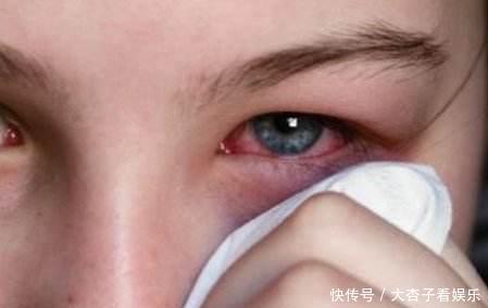  [小妙]眼睛肿了怎么办让眼睛快速消肿的小妙招