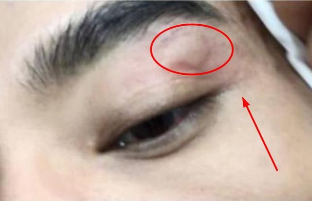 整个剧组全面停工,本以为是“明星耍大牌”,却仅仅是一只蚊子!