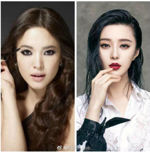 平行和扇形双眼皮该怎么选择？哪个更流行？