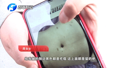 整形@惨!一次整形后,她变得“人不人鬼不鬼”......