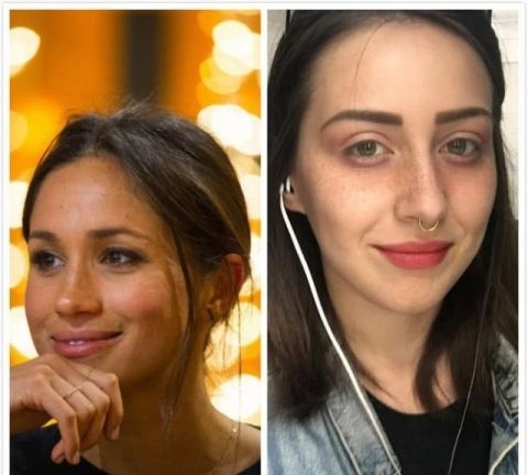 手术:英女子痴迷梅根“雀斑妆”,拙劣手术让面部毁容,花3万治疗修复