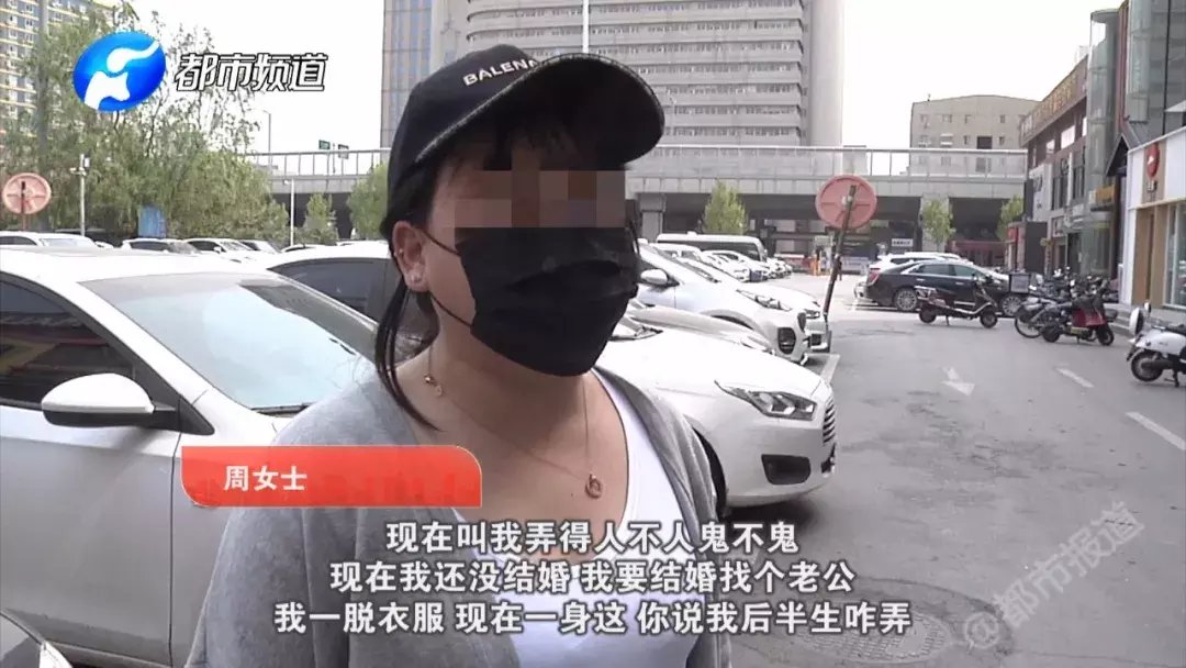 整形@惨!一次整形后,她变得“人不人鬼不鬼”......