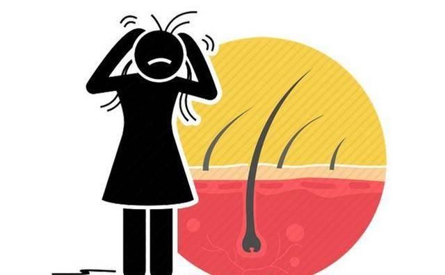  「天然」脱发人群的福音：这7种食物被称天然“增发剂”，不妨多吃一点！