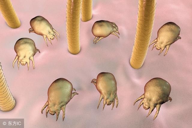 “螨虫”肆虐让人顶着满脸痘痘，只要洗脸加入这两物，能除螨祛痘