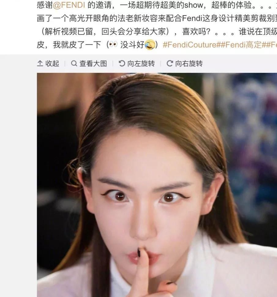 惊!戚薇开眼角了?还是无痛的