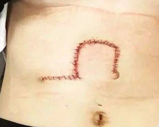 年轻女子发朋友圈晒美照，朋友看到后叫她去医院，真相让人傻了眼