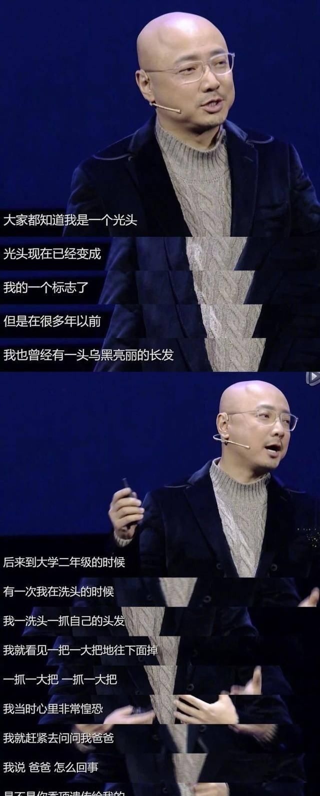  额头：何炅自曝发髻线惊叹网民，原先何老师额头那么亮堂，和赵丽颖有得一拼！