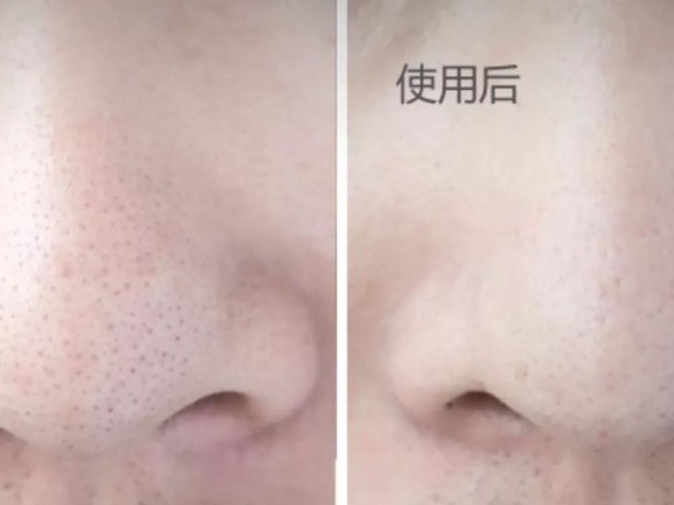 明星素颜哪家强?赵丽颖霍思燕黑头明显，林允真的没毛孔!