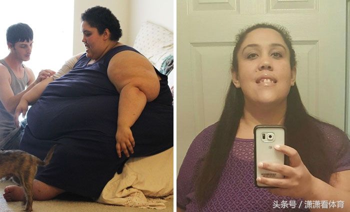 这群体重超过500斤的人仍回归正常，减肥堪比整容!