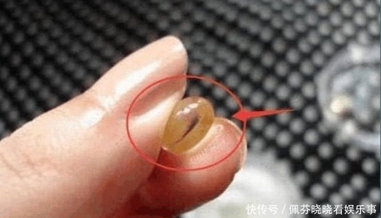  「越来越」“维生素E”没效果? 那是因为你用错方法了, 难怪皮肤越来越差